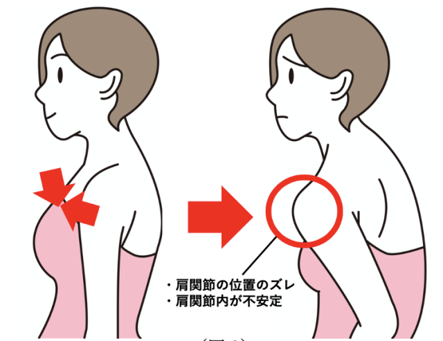 五十肩の痛みの原因は3つの筋肉が問題!特に主婦の人要注意!