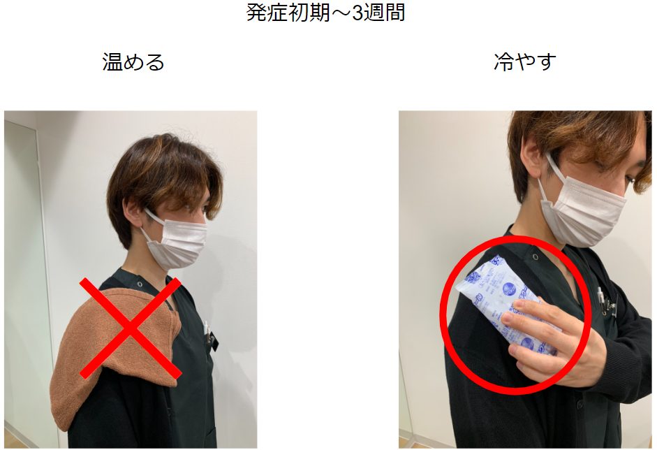 五十肩症状の治療法は冷やす？温める？そんな悩みを解決します！