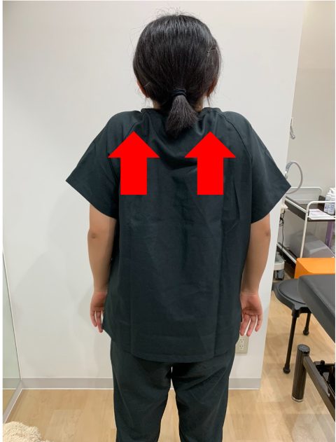 肩こりの原因は首・肩甲骨まわりの筋肉の疲労？P C作業の人要注意！