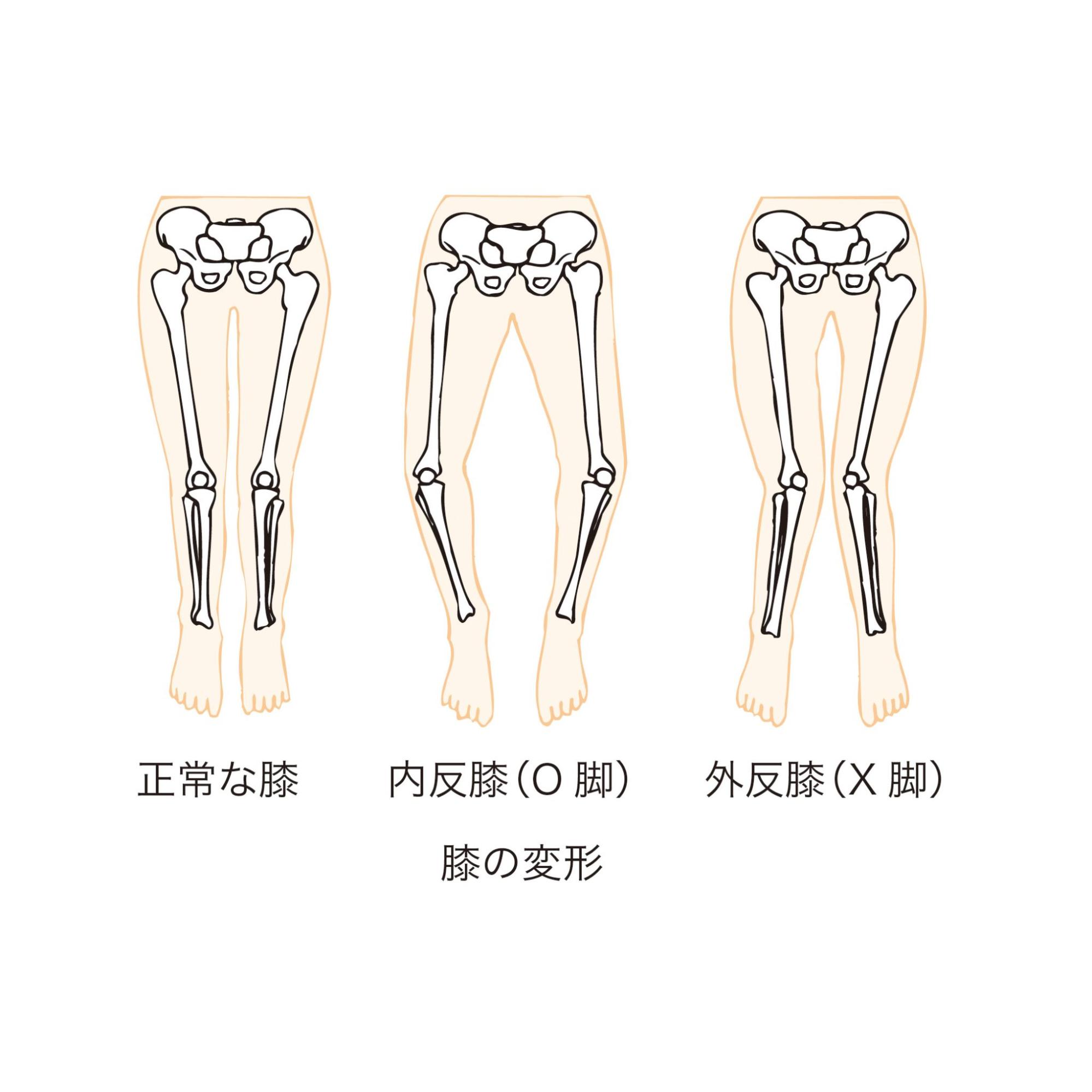 60代で膝の内側に痛みが出たときの対処法は？徹底解説します！