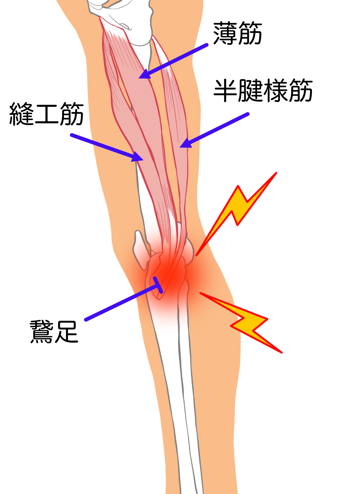 60代で膝の内側に痛みが出たときの対処法は？徹底解説します！