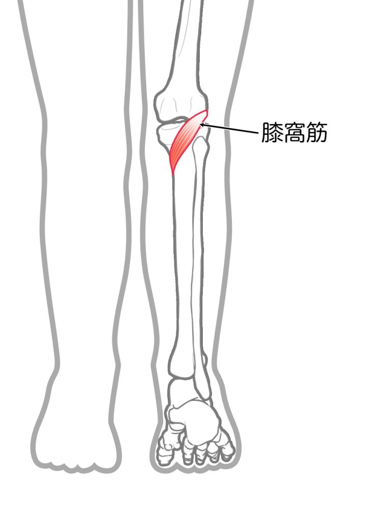 膝の裏の筋肉痛のような痛みの原因について徹底解説！危険な状態かも？