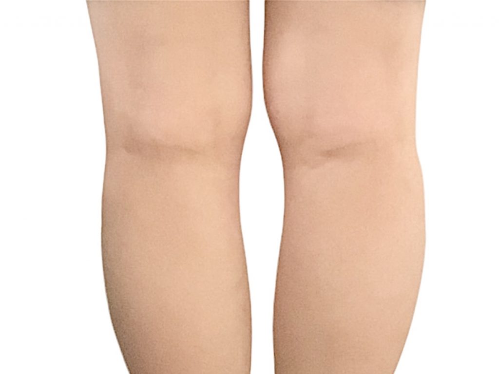 膝の裏の筋肉痛のような痛みの原因について徹底解説！危険な状態かも？