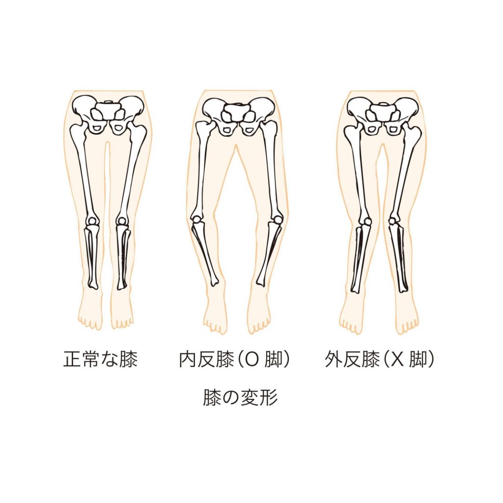 膝の外側に刺すような痛みがある時の原因と治し方を徹底解説！！