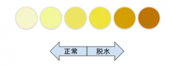 膝のピクピクとは？その症状と特徴
