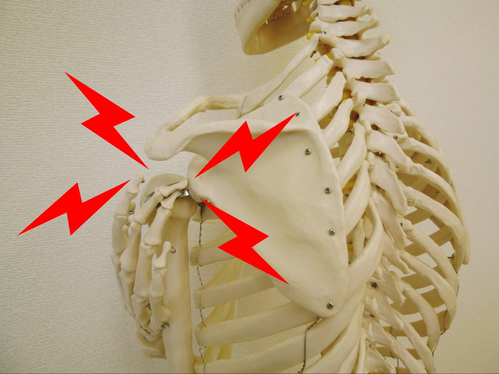 四十肩と五十肩は何が違う？原因や症状と間違いやすい4つの疾患！